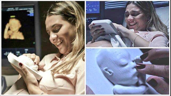 Blinde moeder krijgt 3D print van ongeboren baby